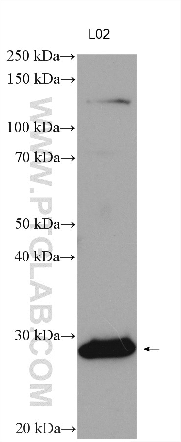 Western Blot (WB) analysis of various lysates using ORM1/2 Polyclonal antibody (11199-1-AP)