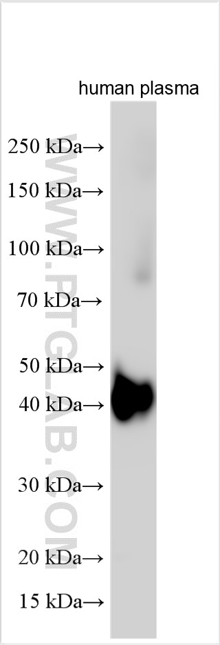 Western Blot (WB) analysis of various lysates using ORM1/2 Polyclonal antibody (11199-1-AP)