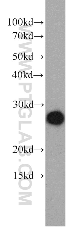 Western Blot (WB) analysis of A549 cells using ORM1/2 Polyclonal antibody (11199-1-AP)