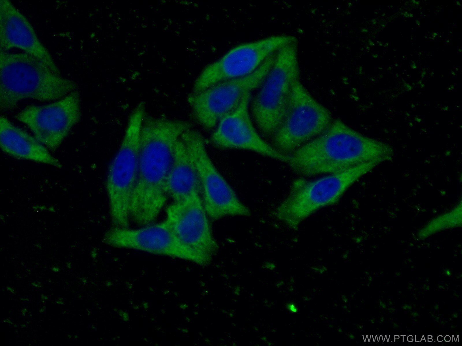 Immunofluorescence (IF) / fluorescent staining of HepG2 cells using ORM2-Specific Monoclonal antibody (66217-1-Ig)