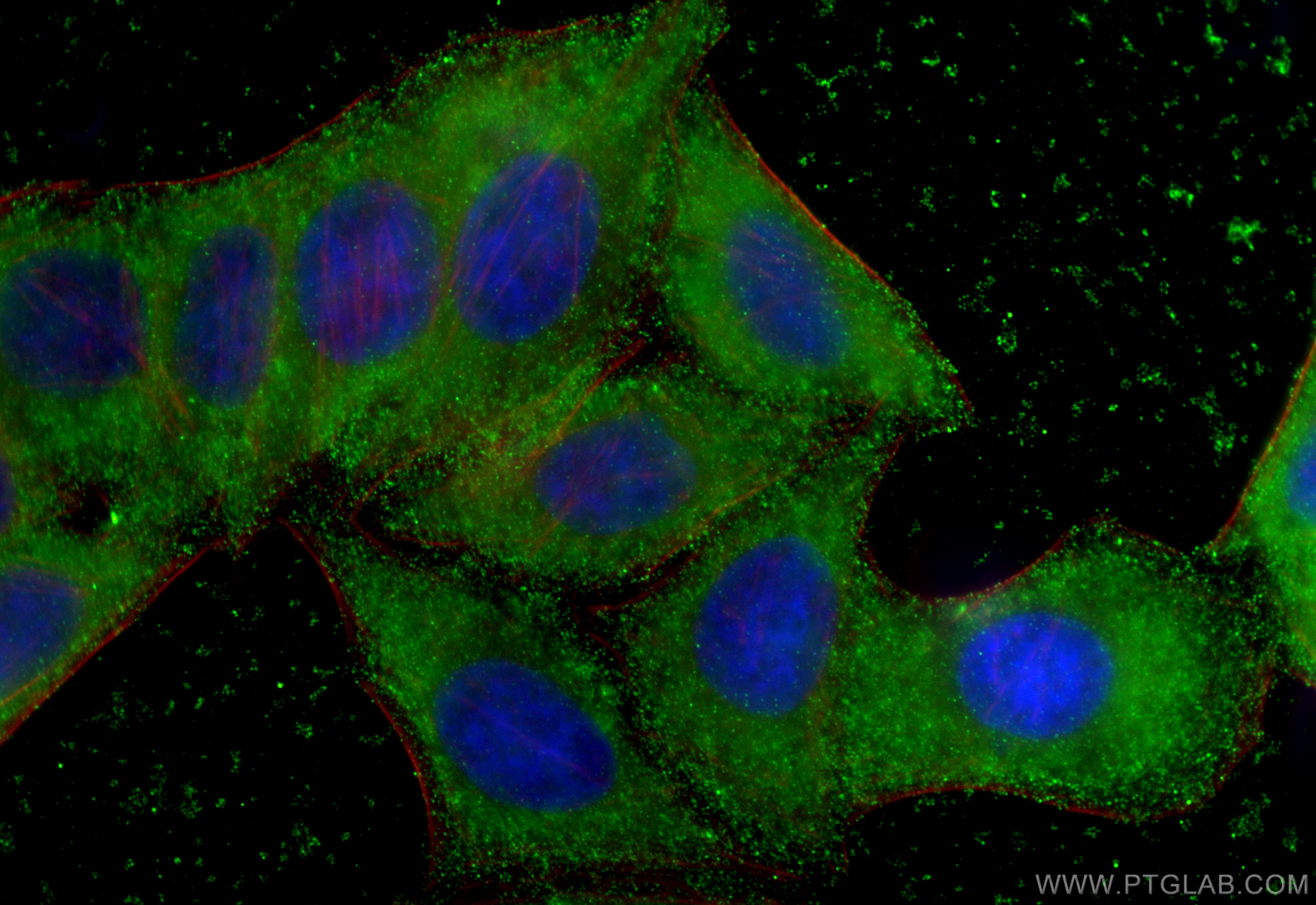 Immunofluorescence (IF) / fluorescent staining of HepG2 cells using ORM2-Specific Monoclonal antibody (66217-1-Ig)