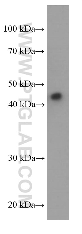Western Blot (WB) analysis of human plasma using ORM2-Specific Monoclonal antibody (66217-1-Ig)