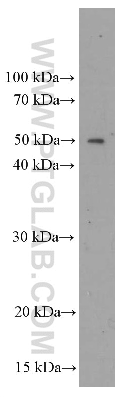 Western Blot (WB) analysis of A549 cells using ORM2-Specific Monoclonal antibody (66217-1-Ig)