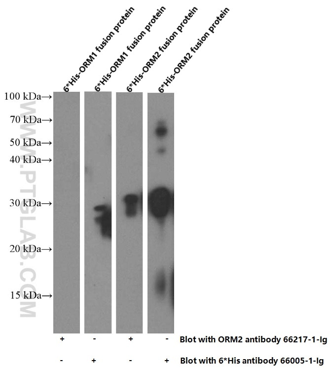 Western Blot (WB) analysis of Recombinant protein using ORM2-Specific Monoclonal antibody (66217-1-Ig)