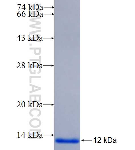 ORMDL1 fusion protein Ag26857 SDS-PAGE