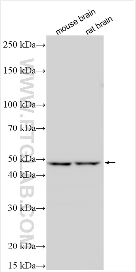 Western Blot (WB) analysis of various lysates using ORP1L Polyclonal antibody (25268-1-AP)
