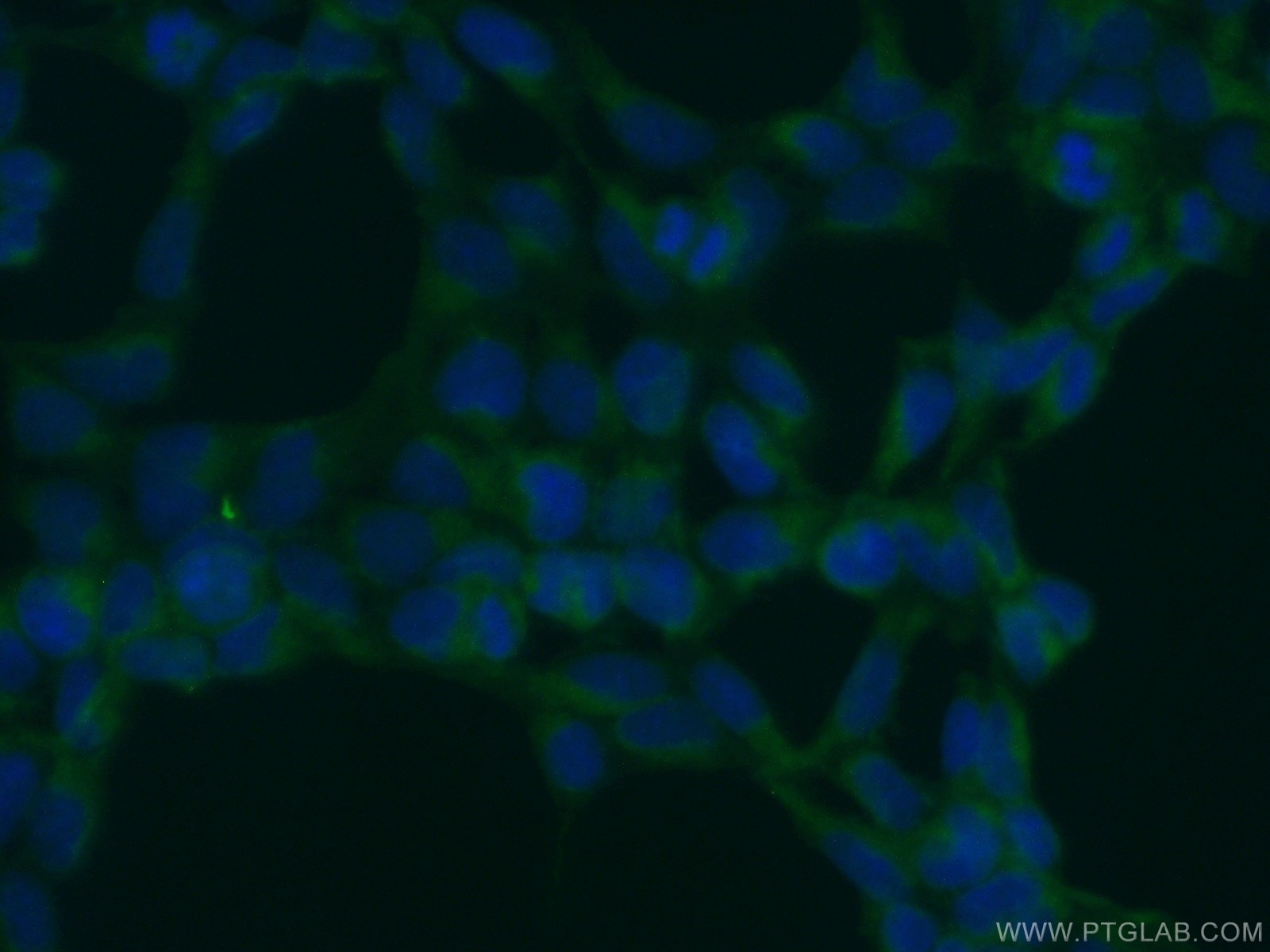 Immunofluorescence (IF) / fluorescent staining of HEK-293 cells using OS9 Polyclonal antibody (10061-1-AP)