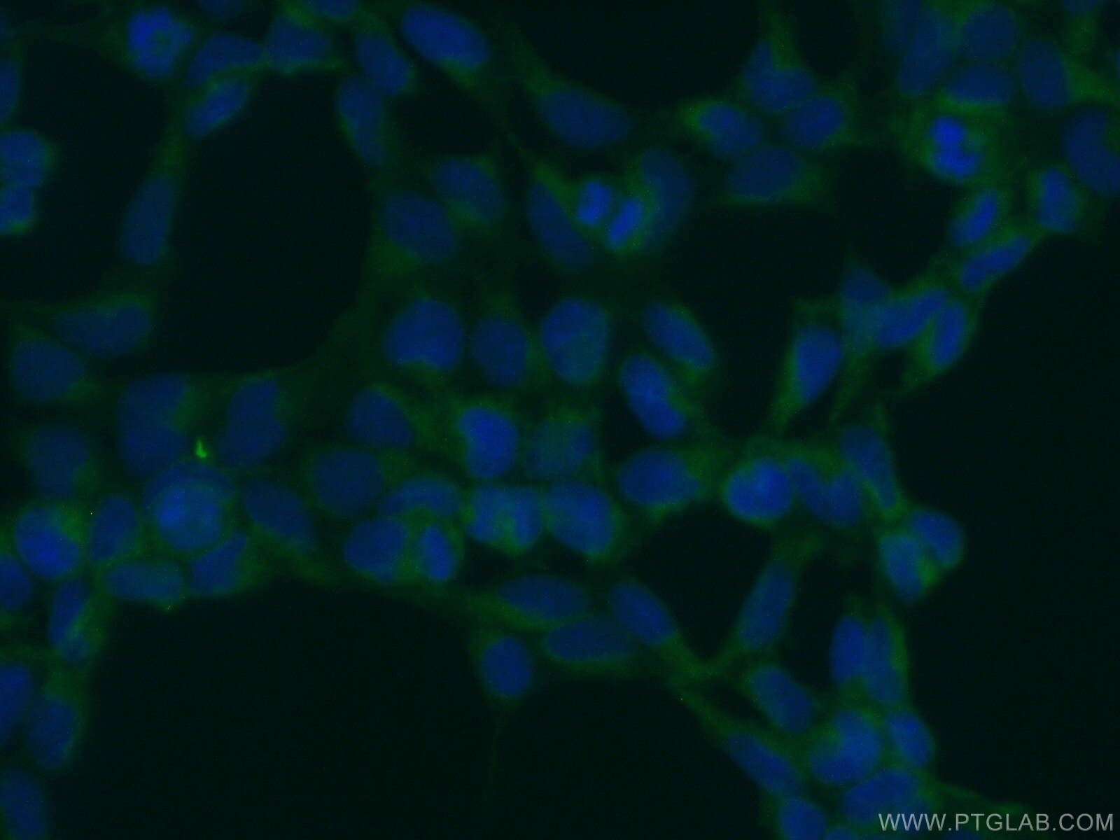 IF Staining of HEK-293 using 10061-1-AP