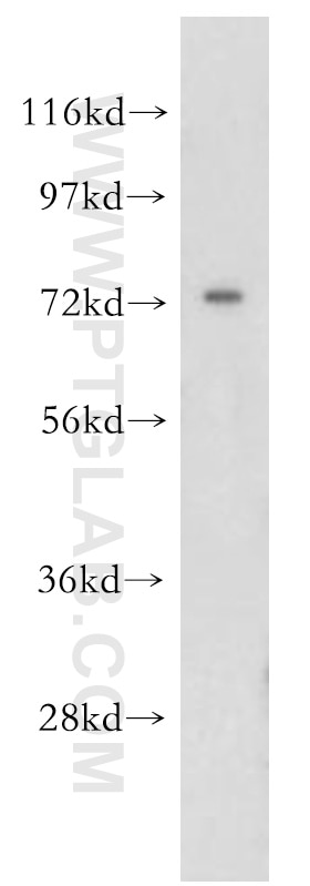 Western Blot (WB) analysis of HeLa cells using OS9 Polyclonal antibody (10061-1-AP)