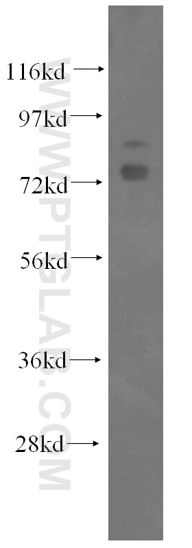 Western Blot (WB) analysis of HEK-293 cells using OS9 Polyclonal antibody (10061-1-AP)