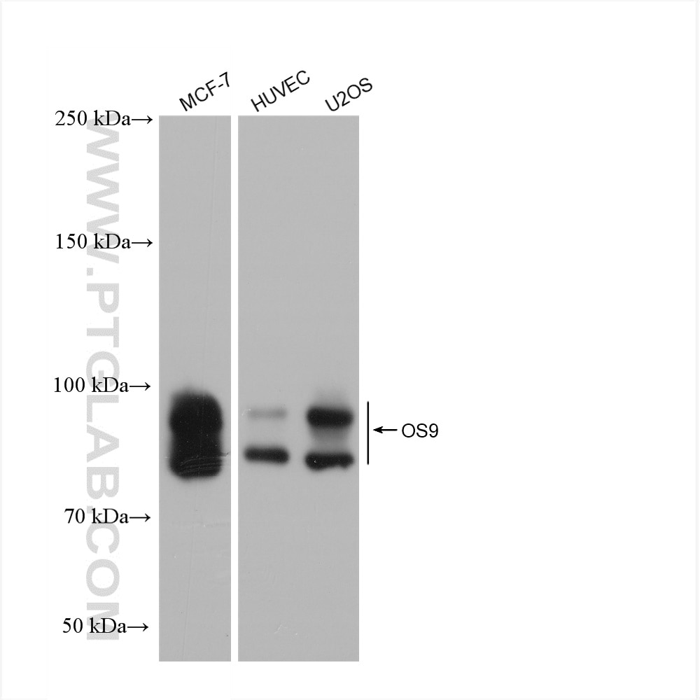 Western Blot (WB) analysis of various lysates using OS9 Recombinant antibody (82932-1-RR)