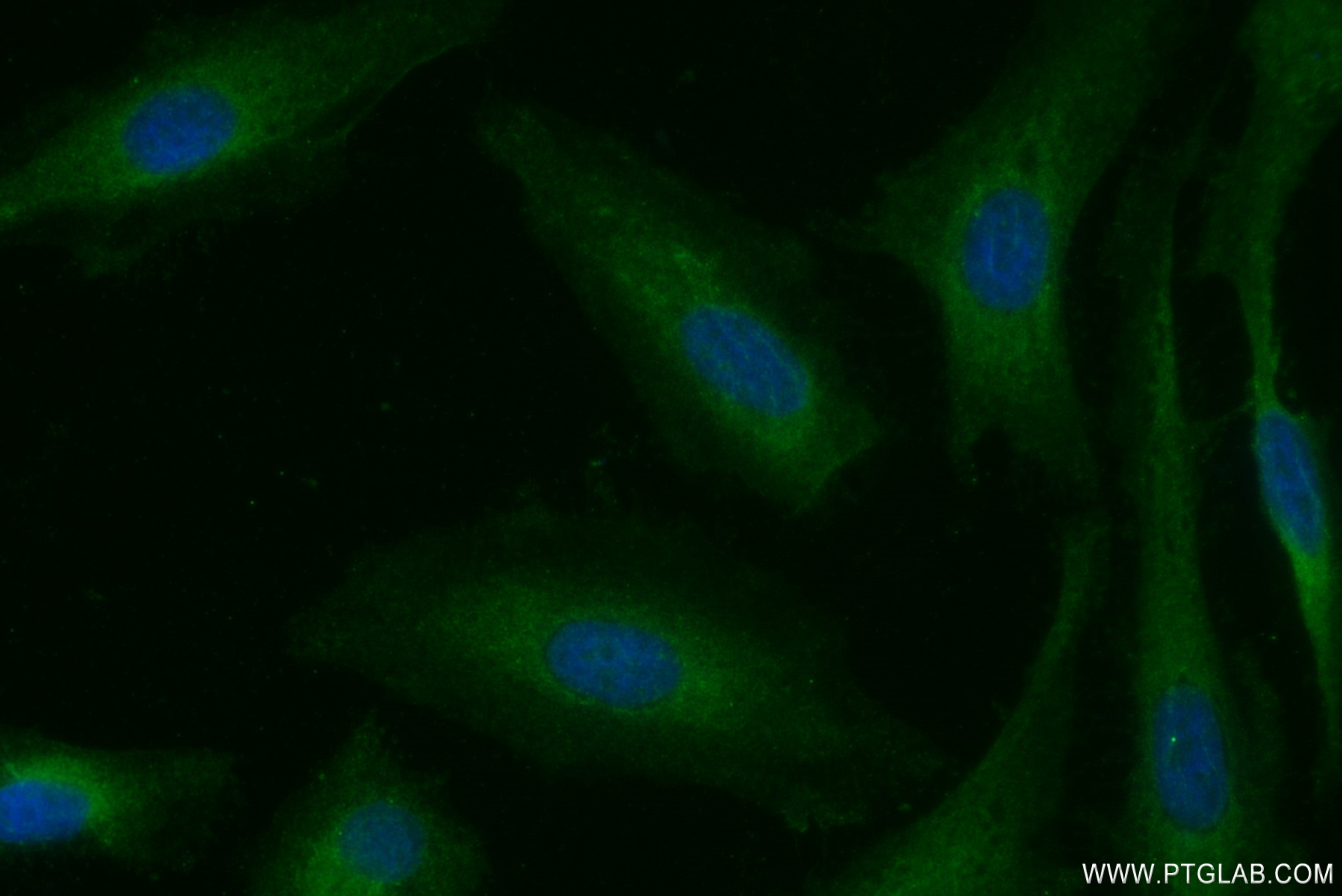 Immunofluorescence (IF) / fluorescent staining of HeLa cells using OS9 Recombinant antibody (82932-2-RR)