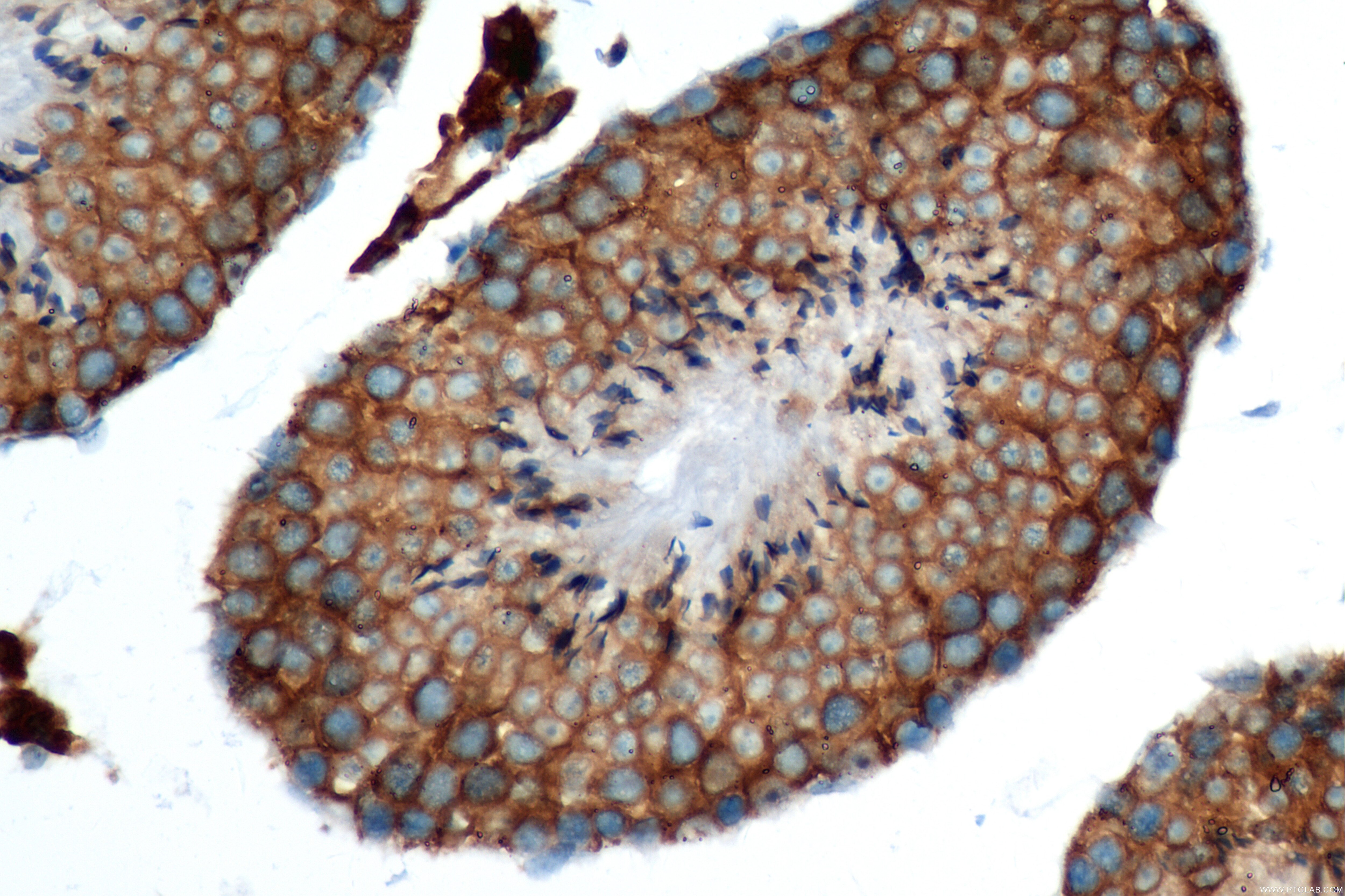Immunohistochemistry (IHC) staining of mouse testis tissue using OS9 Recombinant antibody (82932-2-RR)