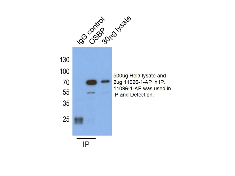 Immunoprecipitation (IP) experiment of HeLa cells using OSBP Polyclonal antibody (11096-1-AP)