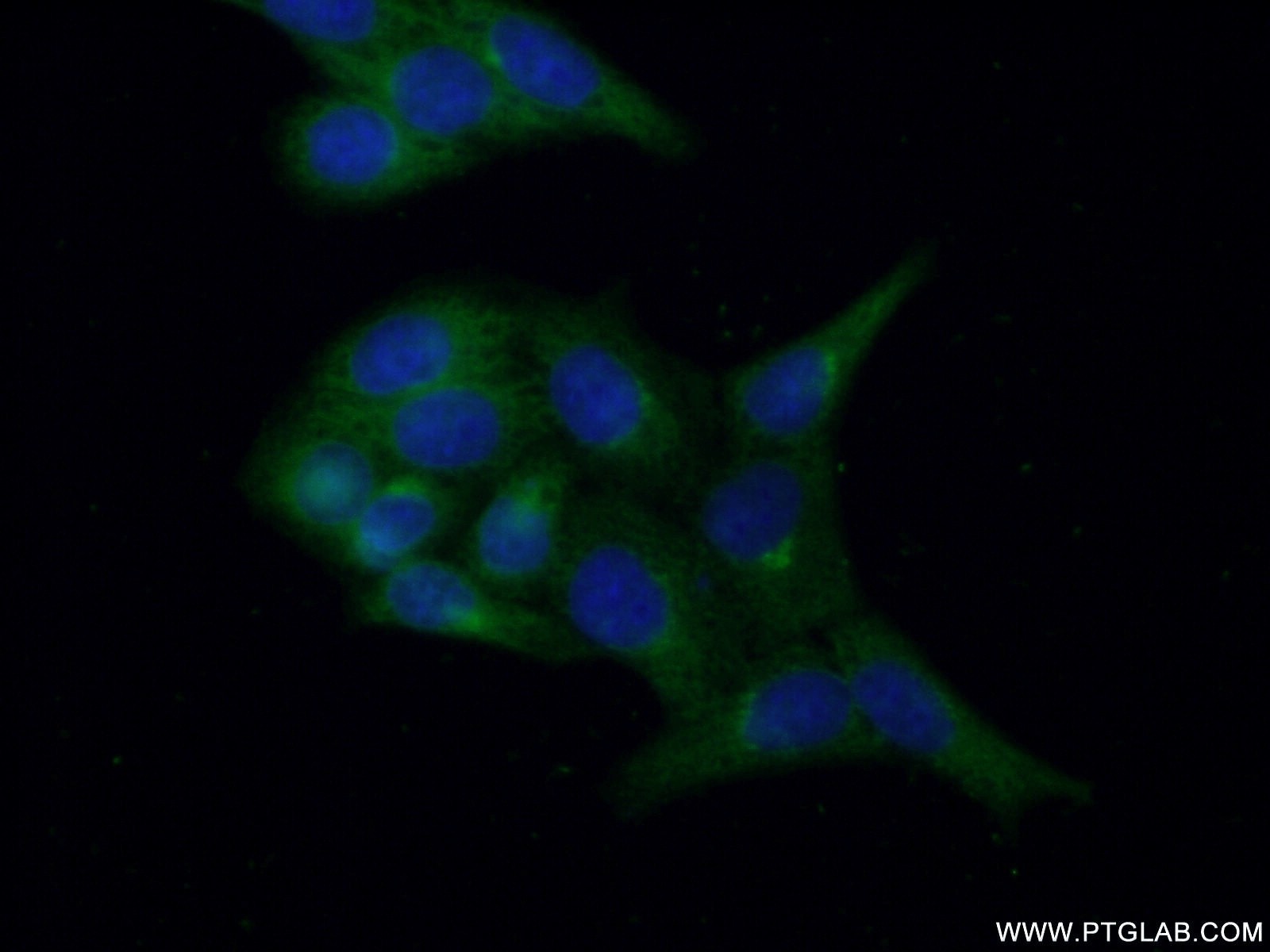 Immunofluorescence (IF) / fluorescent staining of HeLa cells using OSBP Polyclonal antibody (11096-1-AP)