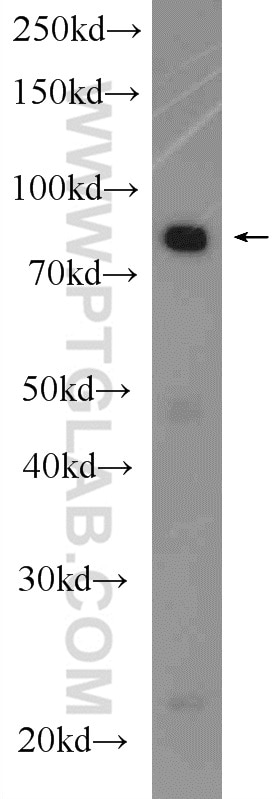 Western Blot (WB) analysis of rat kidney tissue using OSBP Polyclonal antibody (11096-1-AP)