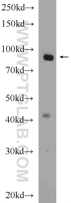 Western Blot (WB) analysis of mouse kidney tissue using OSBP Polyclonal antibody (11096-1-AP)