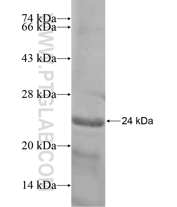 OSBP2 fusion protein Ag17227 SDS-PAGE