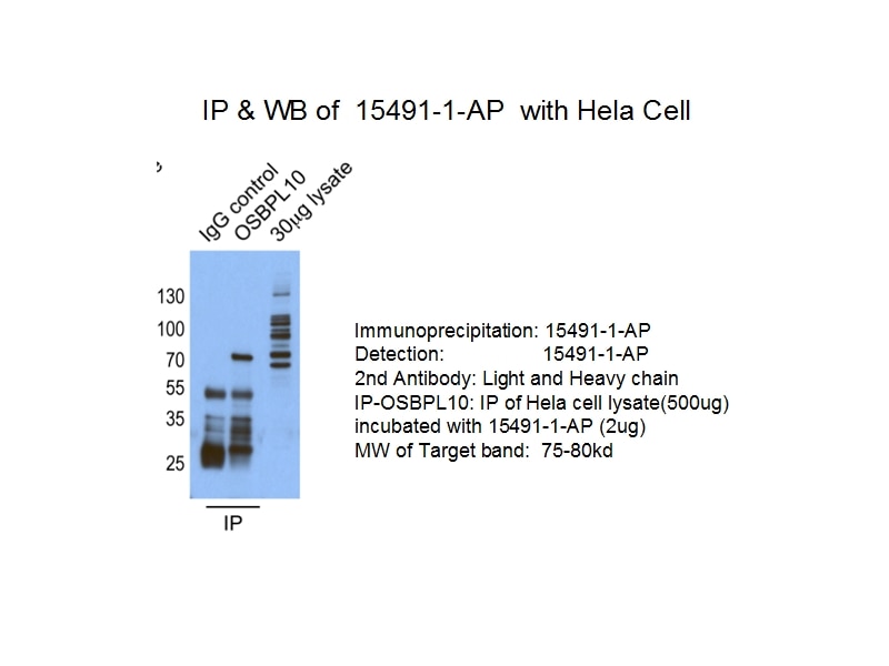 Immunoprecipitation (IP) experiment of HeLa cells using OSBPL10 Polyclonal antibody (15491-1-AP)