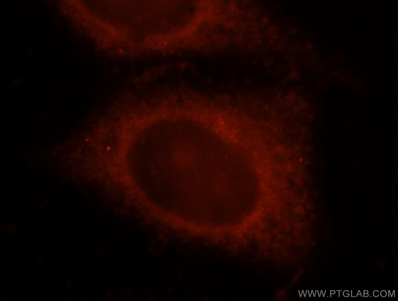 Immunofluorescence (IF) / fluorescent staining of HepG2 cells using OSBPL10 Polyclonal antibody (15491-1-AP)