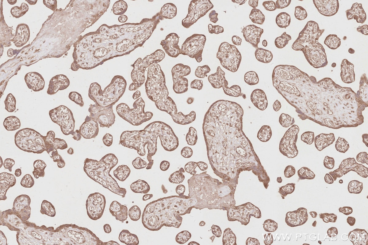 Immunohistochemistry (IHC) staining of human placenta tissue using OSBPL10 Polyclonal antibody (15491-1-AP)