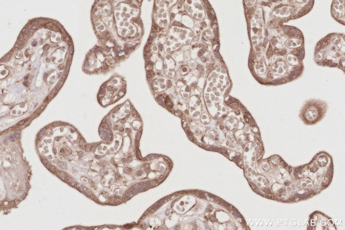 Immunohistochemistry (IHC) staining of human placenta tissue using OSBPL10 Polyclonal antibody (15491-1-AP)