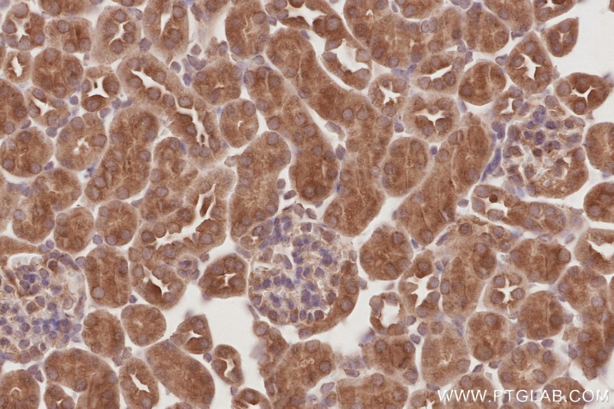 Immunohistochemistry (IHC) staining of mouse kidney tissue using OSBPL10 Polyclonal antibody (15491-1-AP)