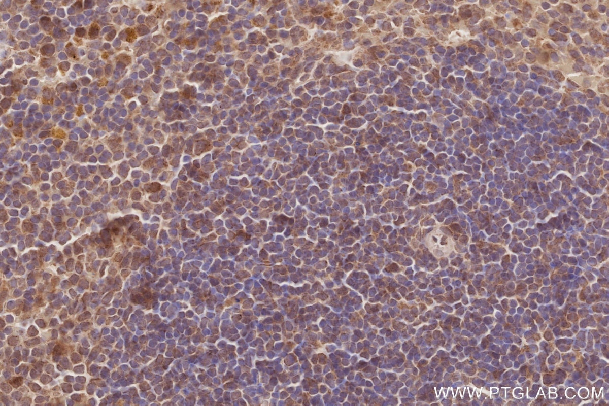 Immunohistochemistry (IHC) staining of mouse spleen tissue using OSBPL10 Polyclonal antibody (15491-1-AP)
