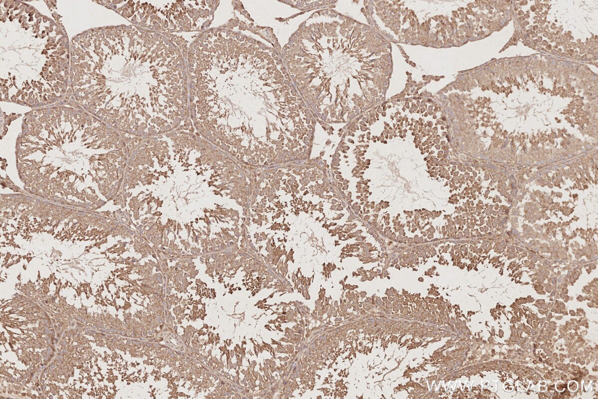 Immunohistochemistry (IHC) staining of rat testis tissue using OSBPL10 Polyclonal antibody (15491-1-AP)