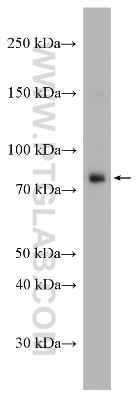 Western Blot (WB) analysis of HepG2 cells using OSBPL10 Polyclonal antibody (15491-1-AP)