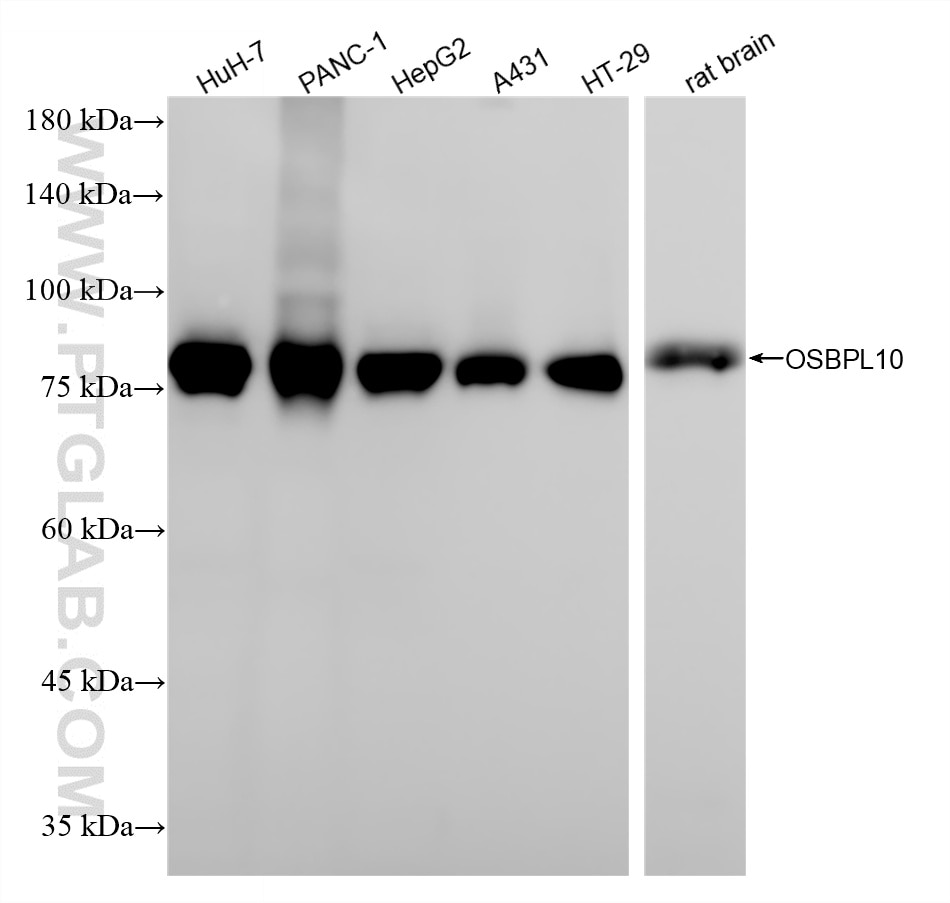Western Blot (WB) analysis of various lysates using OSBPL10 Recombinant monoclonal antibody (87087-1-RR)