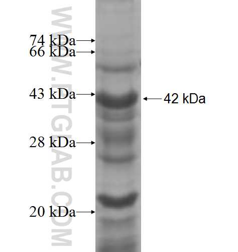 OSBPL10 fusion protein Ag7861 SDS-PAGE