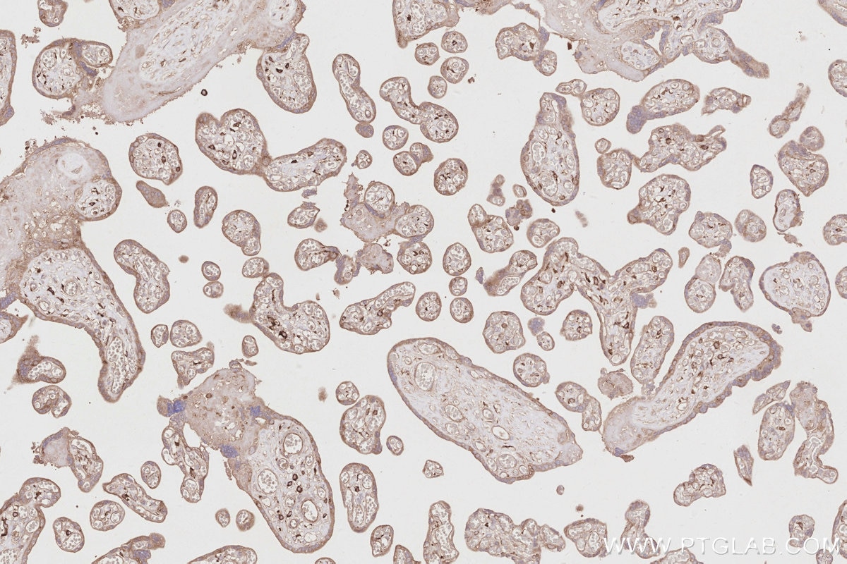 IHC staining of human placenta using 11318-1-AP Immunohistochemistry (IHC) staining of human placenta tissue using OSBPL11 Polyclonal antibody (11318-1-AP)