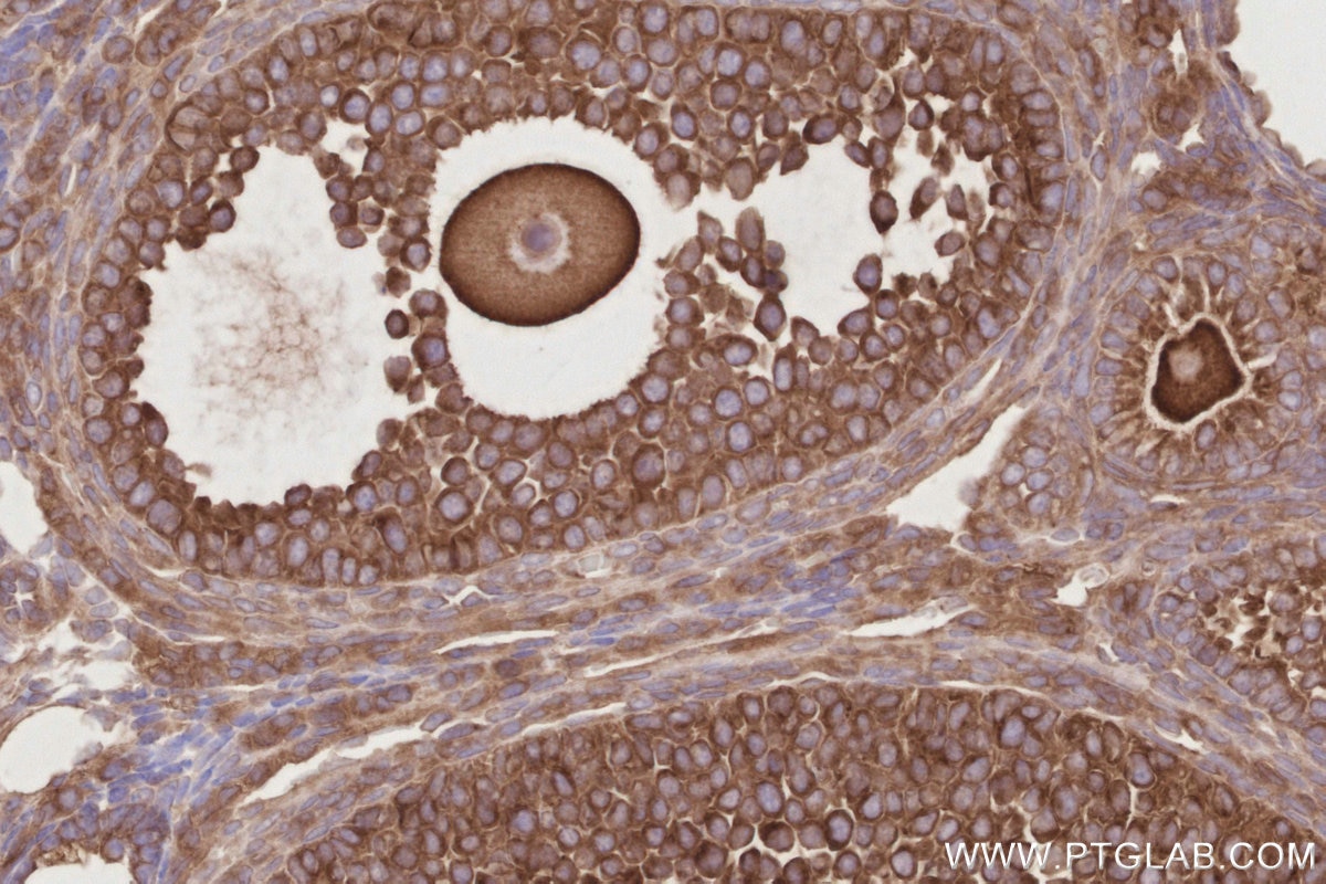 IHC staining of mouse ovary using 11318-1-AP Immunohistochemistry (IHC) staining of mouse ovary tissue using OSBPL11 Polyclonal antibody (11318-1-AP)