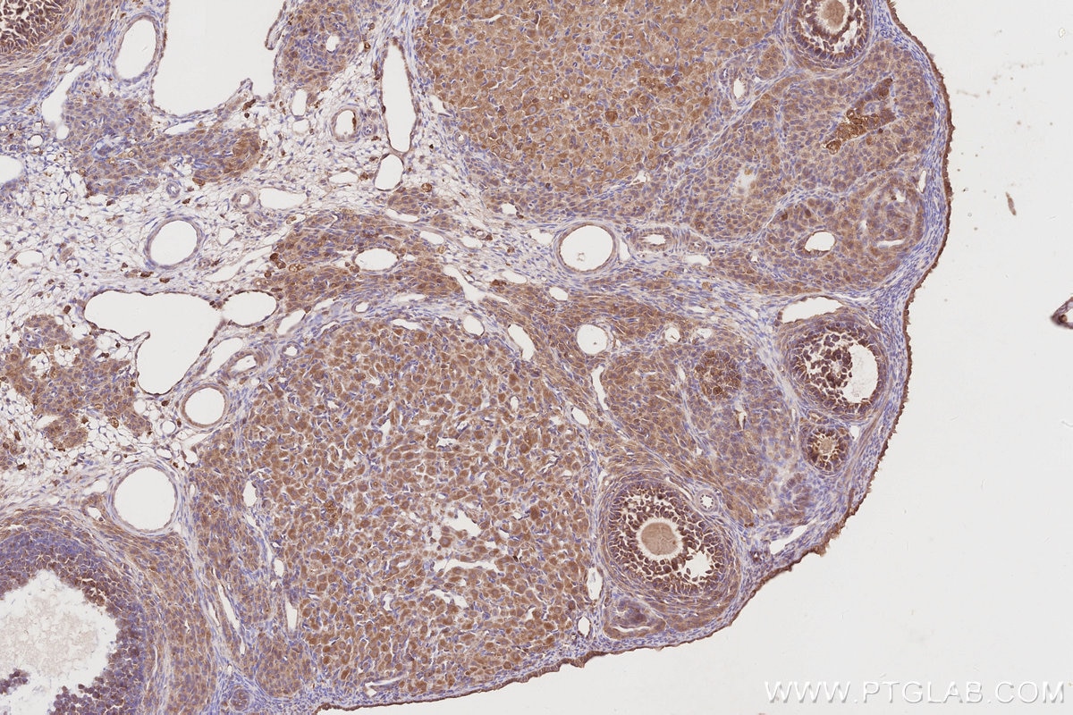 IHC staining of rat ovary using 11318-1-AP Immunohistochemistry (IHC) staining of rat ovary tissue using OSBPL11 Polyclonal antibody (11318-1-AP)