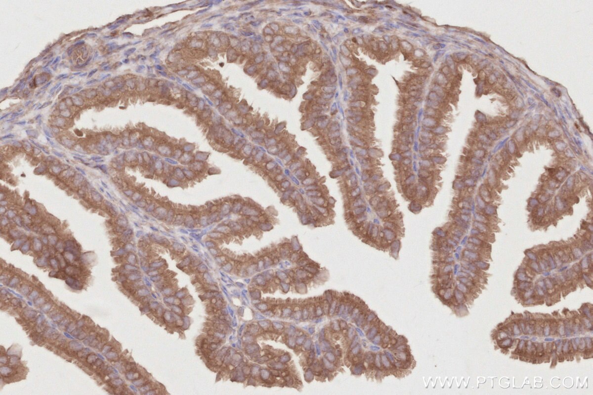 IHC staining of mouse ovary using 11318-1-AP Immunohistochemistry (IHC) staining of mouse ovary tissue using OSBPL11 Polyclonal antibody (11318-1-AP)