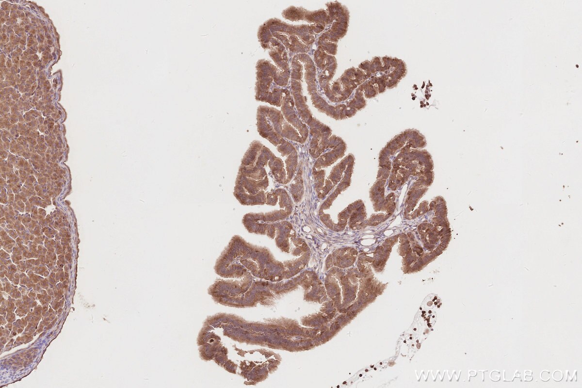 IHC staining of rat ovary using 11318-1-AP Immunohistochemistry (IHC) staining of rat ovary tissue using OSBPL11 Polyclonal antibody (11318-1-AP)