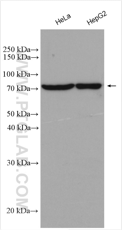 Western Blot (WB) analysis of various lysates using OSBPL11 Polyclonal antibody (11318-1-AP)
