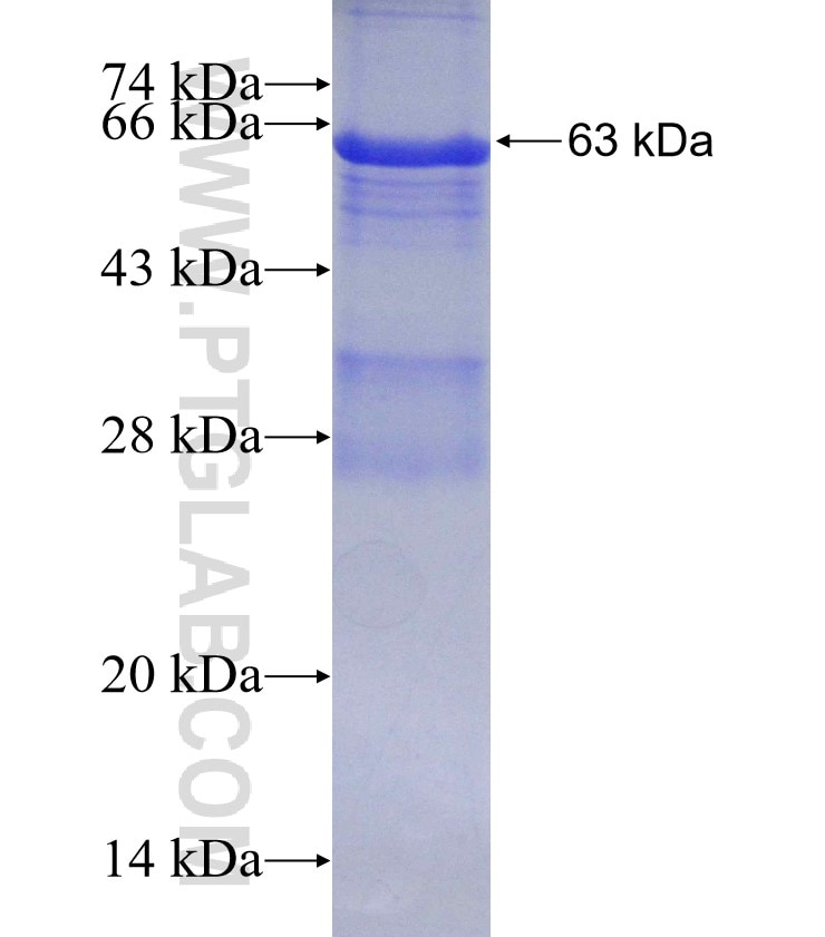 OSBPL11 fusion protein Ag1855 SDS-PAGE