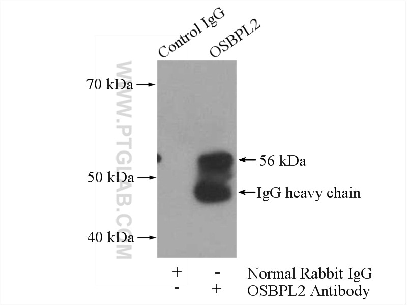 Immunoprecipitation (IP) experiment of HeLa cells using OSBPL2 Polyclonal antibody (14751-1-AP)