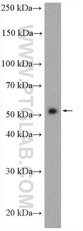 Western Blot (WB) analysis of HuH-7 cells using OSBPL2 Polyclonal antibody (14751-1-AP)