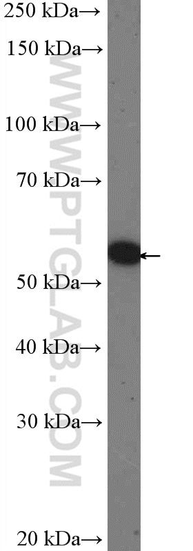 Western Blot (WB) analysis of A549 cells using OSBPL2 Polyclonal antibody (14751-1-AP)
