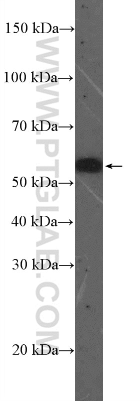 Western Blot (WB) analysis of HeLa cells using OSBPL2 Polyclonal antibody (14751-1-AP)