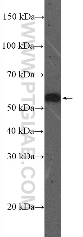 WB analysis of HeLa using 14751-1-AP