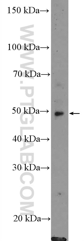 Western Blot (WB) analysis of mouse brain tissue using OSBPL2 Polyclonal antibody (14751-1-AP)