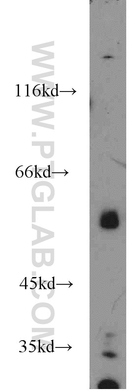 Western Blot (WB) analysis of HeLa cells using OSBPL2 Polyclonal antibody (17217-1-AP)