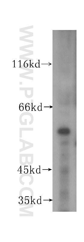 Western Blot (WB) analysis of mouse brain tissue using OSBPL2 Polyclonal antibody (17217-1-AP)