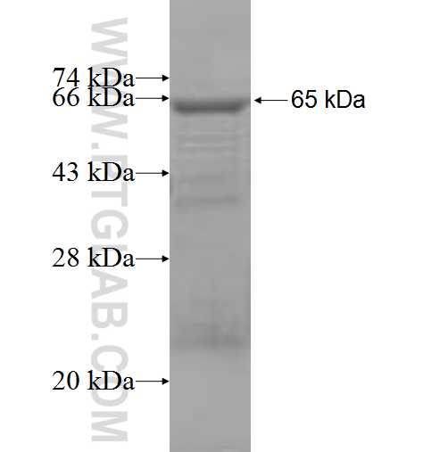 OSBPL2 fusion protein Ag6496 SDS-PAGE
