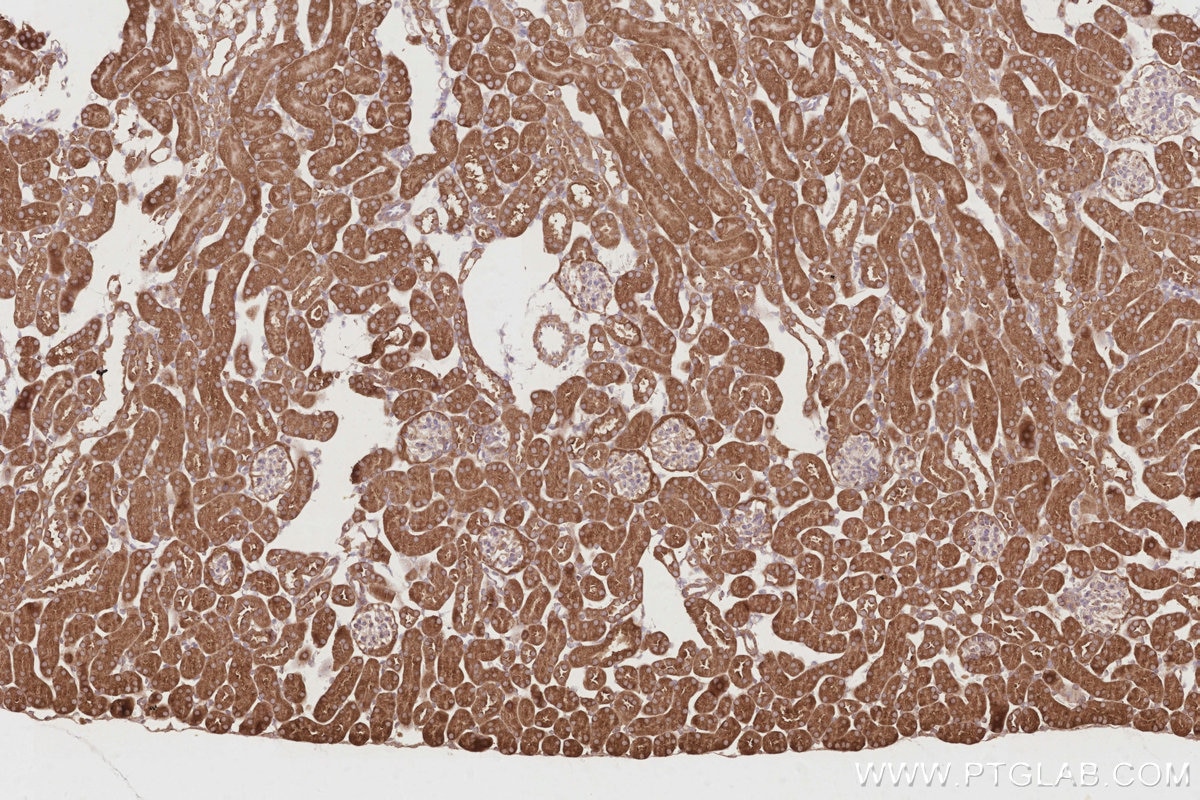 Immunohistochemistry (IHC) staining of mouse kidney tissue using OSBPL3 Polyclonal antibody (12417-1-AP)