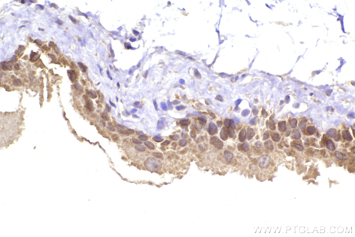 Immunohistochemistry (IHC) staining of mouse bladder tissue using OSBPL3 Polyclonal antibody (12417-1-AP)